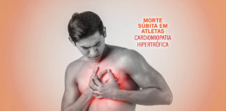 Morte Súbita - Cardiomiopatia Hipertrofica | Paulo Sadala (Revista Correr)