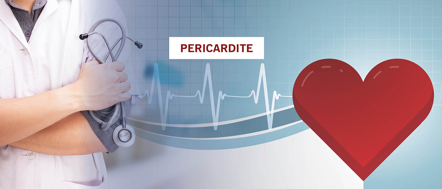 Pericardite - Dr. Paulo Sadala | Revista Correr